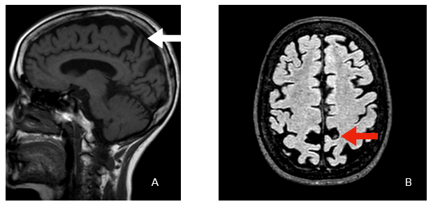 Imagen cerebro